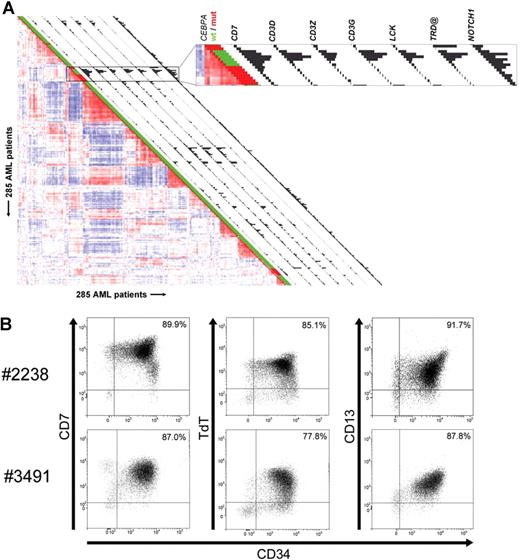 Figure 2. AML cases with silenced CEBPA in cluster no. 4 simultaneously express myeloid- and T-lymphoid–specific genes and lineage markers. (A) Pairwise correlations between samples are displayed as explained in the legend to Figure 1, and GEP cluster no. 4 is enlarged in the box on the right. Histograms next to each patient display expression of selected genes with significantly elevated expression in cluster no. 4 cases with silenced CEBPA. Expression levels for probe sets of the following genes are visualized: CD7, CD3D, CD3Z, CD3G, LCK, TRD@, and NOTCH1. Corresponding expression levels and Affymetrix probe set identifiers are depicted in Table S4. (B) Representative dot plot images from flow cytometric analysis of samples obtained from 2 individual patients (ie, patients no. 2238 and no. 3491) demonstrating that the majority of cells from these patients simultaneously express CD34, CD13, CD7, and terminal deoxynucleotidyltransferase (TdT). The tumor population was identified by its weak expression of CD45, depicted in black, whereas CD45high cells, which are considered to be mature lymphocytes, are colored in gray.