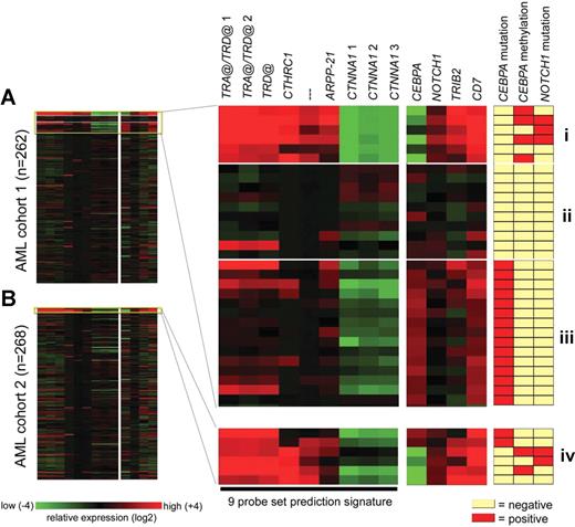 Figure 5. A gene expression prediction signature identifies new leukemias with the silenced CEBPA phenotype in an independent cohort of AML. (A) For 262 samples analyzed on Affymetrix HGU133Plus2.0 GeneChips, log-transformed (base 2) and mean-centered expression levels for 13 probe sets are depicted (left panel) for an arbitrary range from − 4 to + 4 (corresponding to 16-fold lower to 16-fold higher expression relative to the mean, respectively). The ordering of patients in the figure is arbitrary. In the right panel, these data are enlarged for 31 of these 262 leukemias, representing 3 groups: (I) the 6 cases with silenced CEBPA previously identified, with from top to bottom cases no. 2668, no. 2238, no. 3314, no. 2686, no. 3483, and no. 3491; (II) a variable selection of 10 AMLs from distinct GEP clusters for which also NOTCH1 mutational analysis and CEBPA promoter bisulfite sequencing were performed; and (III) 15 AMLs with CEBPA mutations, originating from either GEP cluster no. 4 (upper 9 samples) or cluster no. 15 (lower 6 samples). The 9 probe sets on the left side constitute the most predictive gene expression signature for group I, as determined by PAM: 216191_s_at (TRA@/TRD@ 1), 217143_s_at (TRA@/TRD@ 2), 213830_at (TRD@), 225681_at (CTHRC1), 1565809_x_at (no annotation), 1560018_at (ARPP-21), 210844_x_at (CTNNA1 1), 200764_s_at (CTNNA1 2), and 200765_x_at (CTNNA1 3). To the right, 4 additional probe sets are indicated, that is, 204039_at (CEBPA), 218902_at (NOTCH1), 202478_at (TRIB2), and 214551_s_at (CD7). Mutational data for NOTCH1 and CEBPA, and methylation status of the CEBPA promoter are depicted next to the normalized hybridization intensities of the probe sets. (B) Two hundred sixty-eight samples obtained from a second cohort of AML were hybridized to HGU133Plus2.0 GeneChips. The 9 probe set signature was used to identify leukemias with a profile similar to group I (A), resulting in the detection of group IV (from top to bottom cases no. 6376, no. 6735, no. 6947, no. 7053, no. 7076, and no. 7120).