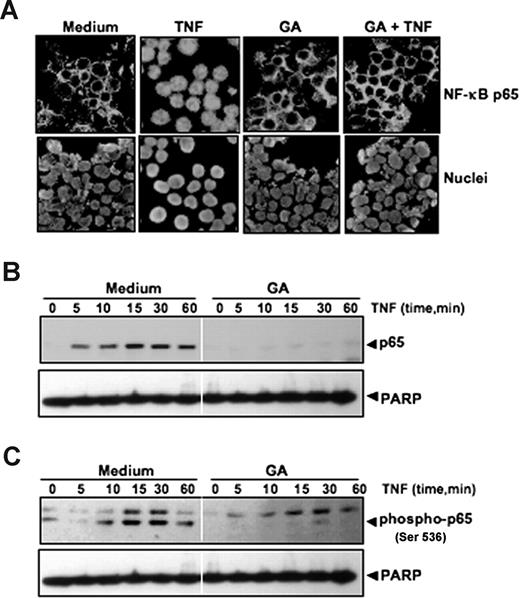 Figure 5. GA inhibits TNF-induced phosphorylation and nuclear translocation of p65. (A) Immunocytochemical analysis of p65 localization. KBM-5 cells were first treated with 5 μM GA for 4 hours at 37°C and then exposed to 0.1 nM TNF for 15 minutes. After the cells were centrifuged, they underwent immunocytochemical analysis. (B,C) GA inhibits TNF-induced nuclear translocation and phosphorylation of p65. KBM-5 cells were either untreated or pretreated with 5 μM GA for 4 hours at 37°C and then treated with 0.1 nM TNF for the indicated times. Nuclear extracts were prepared and analyzed by Western blotting with antibodies against p65 and phospho-specific p65. For loading control of nuclear protein, the membrane was blotted with anti-PARP antibody.