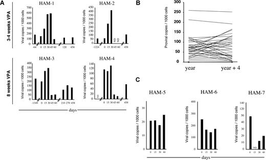 Figure 4. Pilot study of valproate-based therapy in HAM/TSP patients. (A) The PVLs were determined by real-time PCR at the indicated days of the valproate treatment. The PVLs are represented in number of copies per 1000 cells. ND indicates not determined. (B) The PVLs at 4-year intervals were determined by real-time PCR in 36 HAM/TSP patients. The PVLs are represented in number of copies per 1000 cells. (C) Three HAM/TSP patients (HAM-5, HAM-6, and HAM-7) were treated with AZT + 3TC for 2 months. The PVLs were determined by real-time PCR at the indicated days and are represented in number of copies per 1000 cells.