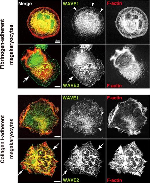 Figure 1. Expression and distribution of WAVE1 and WAVE2 in fibrinogen- and collagen-adherent MKs derived from ES cells. On day 12 of the differentiation protocol, MKs were plated onto 100 μg/mL fibrinogen, or onto 10 μg/mL collagen I, and allowed to stand for 60 minutes. Cells were fixed, permeabilized, and stained with rhodamine-conjugated phalloidin to mark F-actin (red) and with anti-WAVE1 or anti-WAVE2 antibodies followed by Alexa 488 (green), and analyzed by confocal microscopy. Scale bar equals 10 μm. See “Image acquisition for platelet and MK spreading” for complete image acquisition information.