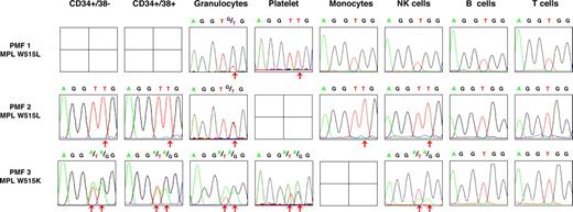 Figure 2. Detection of MPL 1544 G>T and MPL 1543 TG>AA (MPL W515) mutations in peripheral blood cells from PMF patients. Peripheral cells from MPL-mutated PMF patients were isolated using standard density, immunomagnetic and flow cytometric methods for further DNA extraction, and sequence analysis. The MPL 1544 G>T and MPL 1543 TG>AA mutations were detected in some CD34+ cells, granulocytes, and platelets cells from 2 of the PMF patients. The CD34+/38− cells, CD34+/38+ cells, granulocytes, platelets, monocytes, NK cells, and T- and B-cell sequence traces from 3 PMF patients are shown. Red arrows indicate the presence of a mutant peak.