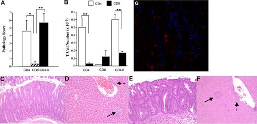Figure 1. CD4+ T cells are necessary for the induction of GVHD-associated autoimmunity. Lethally irradiated (900 cGy) Balb/c mice received transplants of TCD B6 BM plus 3 × 105 B6 spleen cells. At 19 to 21 days after BMT, animals were killed and cohorts of nonirradiated B6 Rag mice received transplants of either purified CD4+ (n = 18), CD8+ (n = 8), or the combination of CD4+ and CD8+ T cells (n = 24) from pooled spleen cell suspensions using the MACS isolation system. B6 Rag animals were then killed 35 to 74 days after transfer. (A) Overall pathological score, as defined in “Histologic analysis,” of mice that received transplants of either CD4+ (□), CD8+ (▨), or CD4+ and CD8+ T cells (■). The CD4+ T-cell dose ranged from 0.3 to 0.5 × 106 (mean, 0.43 × 106), while the CD8+ T-cell dose ranged from 0.35 to 0.5 × 106 (mean, 0.43 × 106). Animals that received transplants of the combination of CD4+ and CD8+ T cells received 0.5 × 106 cells (mean, 3 × 105 CD4+ and 2 × 105 CD8+ T cells). Results are derived from 3 to 5 experiments per T-cell group. Data are presented as the mean plus or minus SEM. (B) Absolute number of CD4+ (□) or CD8+ (■) T cells in the spleens of mice that received transplants of purified CD4+, CD8+, or CD4+ and CD8+ T cells from B6→ Balb chimeras. Data are presented as the mean plus or minus SEM. (C-F) Histology of colon (C,E) and liver (D,F) from representative B6 Rag recipients that received either purified CD4+ T cells (C,D) or both CD4+ and CD8+ T cells (E,F) from primary (B6→ Balb) GVHD animals. Colons show marked infiltration of mononuclear and granulocytic cells into the lamina propria along with extensive goblet cell depletion. Livers reveal portal (dashed arrows) and lobular (solid arrows) inflammation with mononuclear and granulocytic infiltrates. (G) Immunofluorescence staining from the colon of a representative B6 Rag mouse that received purified CD4+ and CD8+ T cells from primary GVHD animals showing infiltration of the lamina propria with both CD4+ (blue) and CD8+ (red) T cells. Statistics: *P ≤ .05; **P < .01.