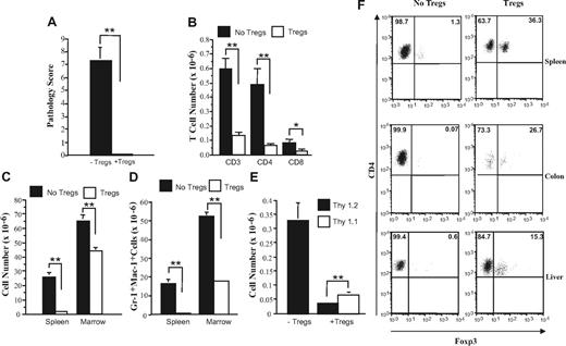 Figure 3. CD4+CD25+ regulatory T cells protect mice from developing autoimmunity. Lethally irradiated (900 cGy) Balb/c mice received transplants of TCD B6 BM (10 × 106) plus 3-4 × 105 B6 spleen cells. At 20 days after BMT, mice were killed, and spleen cells (adjusted to yield 0.5 × 106 T cells) were transferred either alone (n = 7) or together with an equivalent number of CD4+ CD25+ T cells (n = 7) into nonirradiated B6 Rag animals. Mice were killed 42 to 87 days after BMT. (A) Overall pathology score of mice that received transplants of GVHD spleen cells alone (■) or together with Tregs (□). (B) Absolute number of CD3+, CD4+, and CD8+ T cells in the spleens of mice that received transplants of GVHD spleen cells alone (■) or with CD4+CD25+ Tregs (□). (C,D) Overall cellularity and absolute number of Gr-1+ Mac-1+ cells in the spleen and bone marrow of mice that received transplants of GVHD spleen cells alone (■) or together with Tregs (□). (E) Absolute number of Thy 1.2+ (■) or Thy1.1+ (□) T cells in the spleens of mice that received transplants of GVHD spleen cells alone or together with CD4+CD25+ T cells. Data in Figure 3A-E are presented as the mean plus or minus SEM and are the cumulative results of 2 experiments. (F) Spleen cells, hepatic lymphocytes, and IELs from the colon were isolated from mice with autoimmunity and similarly from animals that had received transplants that were coadministered Tregs and had no evidence of pathological damage. The percentage of foxp3-expressing cells in the gated CD4+ T-cell population from each tissue site is depicted by the numbers in the quadrants. Statistics: *P < .05; **P < .01.