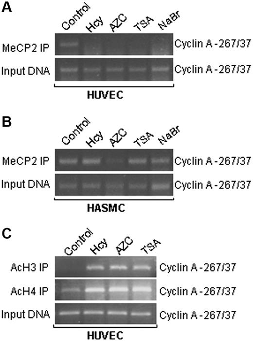 Figure 6. Chromatin remodeling (CHIP assay). HUVECs and HASMCs were treated with 50 μM DL-Hcy and 1 mM AZC in control medium for 48 hours, or 300 nM TSA and 5 mM NaBr for 24 hours. Nuclear extracts were immunoprecipitated with antibody against MeCP2 (A,B), and AcH3 or AcH4 (C). PCR was performed using primers specific for cyclin A promoter from position −267 to 37. Input DNA was amplified to evaluate the total amount of DNA applied to the immunoprecipitation.
