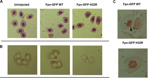 Figure 2. Effect of expression of mutant Fpn on erythroid cell development. Blood samples from embryos treated as in Figure 1 were stained with Wright-Giemsa (A), diaminobenzidine (B), or Prussian blue (C). The arrow shows iron accumulation in erythrocytes from embryos expressing wild-type Fpn-GFP, but not in embryos expressing Fpn-GFP H32R.