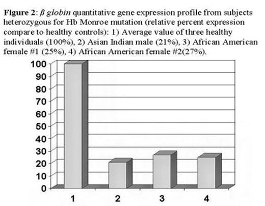 Figure 2:. β globin quantitative gene expression profile from subjects heterozygous for Hb Monroe mutation (relative percent expression compare to healthy controls): 1) Average value of three healthy individuals (100%), 2) Asian Indian male (21%), 3) African American female #1 (25%), 4) African American female #2(27%)