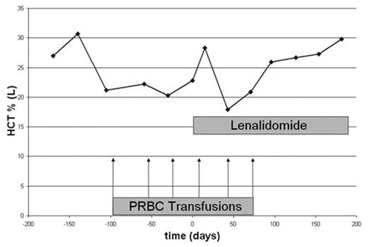 Figure 1. HCT before and after lenalidomide treatment (patient 1)