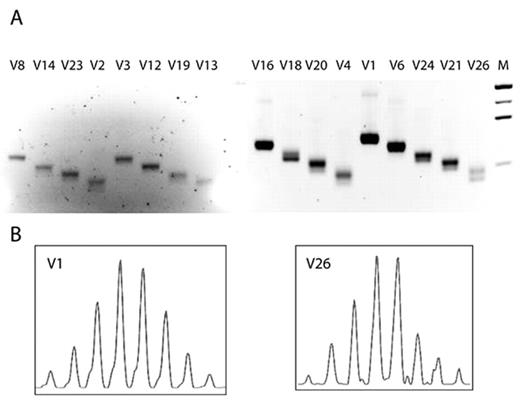 Figure 1. TCRB spectratype of fetal canine thymus. (A) RT-PCR using TCRBV family-specific forward primers (V1 through V26) and a common C region-specific reverse primer. (B) Amplification products specific for family V1 (high abundance) and V26 (low abundance) were copied in run-off reactions with the fluorescent C-specific primer and resolved on capillary gel.