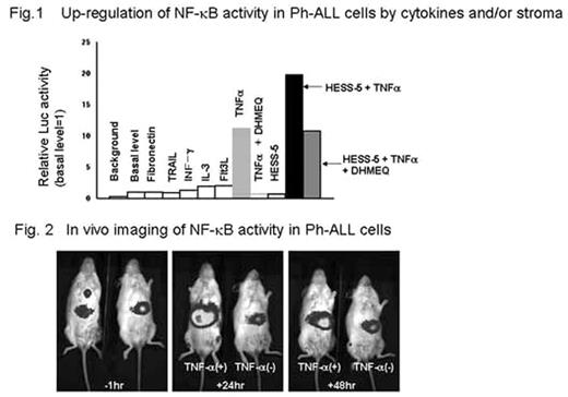 Fig. 1. Up-regulation of NF-κB activity in Ph-ALL cells by cytokines and/or stroma. . / Fig. 2 In vivo imaging of NF-κB activity in Ph-ALL cells