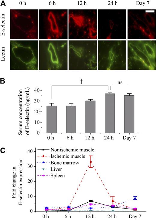 Figure 1. Sequential changes of mE-selectin in vessels, sE-selectin in serum, and mRNA levels for E-selectin in various tissues after induction of limb ischemia in mice. (A) Immunofluorescent staining of mE-selectin (red) and murine EC (BS-1 lectin, green) in muscle after ischemia (scale bar is 200 μm). The expression level of mE-selectin was low in vessels of nonischemic muscle (0 hour). However, it peaked between 6 and 12 hours after ischemia and returned to baseline level by 24 hours. It showed no change at day 7. (B) ELISA analysis showed the changes of sE-selectin concentration in serum after ischemia. sE-selectin increased gradually over 24 hours. It was still high at 7 days (†P < .05; n = 4). ns indicates not significant. (C) Real-time RT-PCR demonstrated the comparison of E-selectin mRNA expression in various tissues after ischemia (n = 4). The level of mRNA for E-selectin in ischemic muscle showed a remarkably high peak around 12 hours after induction of ischemia, whereas nonischemic muscle showed a mild increase at 12 hours. In bone marrow, it was maintained at a high level at day 7. On the other hand, it had been low throughout 7 days in other tissues such as liver and spleen. Error bars in panels B and C represent SD.