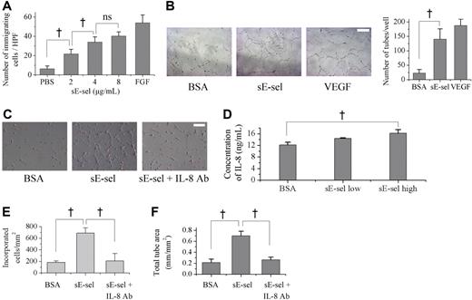 Figure 5. The chemotaxis and tube formation of EPCs by sE-selectin. (A) Modified Boyden chamber assay showed that sE-selectin (sE-sel) enhanced chemotaxis of EPC dose-dependently. PBS and FGF were used as negative and positive control, respectively (†P < .05; ns, P = .08; n = 4). (B) Capillary tube formation on matrigel (scale bar, 50 μm). sE-selectin induced the capillary tube formation of EPC as much as VEGF, positive control in contrast to BSA, negative control (BSA vs sE-selectin = 22.5 ± 12.6 vs 140.0 ± 35.6; †P < .05; n = 4). (C) Representative figure of EPCs, incubated on the ECM (scale bar, 50 μm). EPCs that were labeled with DiI (red) and HUVEC were cocultured. (D) Concentration of interleukin-8 (IL-8) in supernatant measured by ELISA. EPCs secreted a higher level of IL-8 when they were treated with sE-selectin (†P < .05; n = 4). (E, F) More incorporation of EPCs to ECs (E) and more capillary tube formation of EPCs (F) were observed when sE-selectin was added to culture media. Both effects were attenuated by blocking IL-8. (†P < .05; n = 4). Error bars in panels A, B, D-F represent SD.