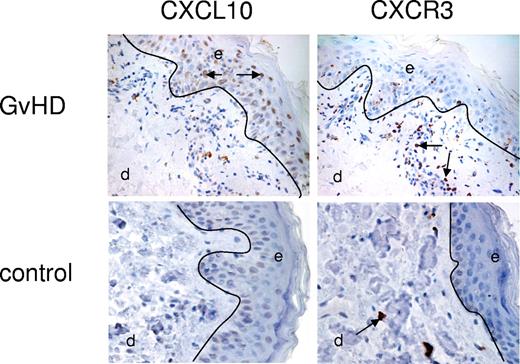 Figure 4. Expression of CXCL10 and CXCR3 in skin biopsies from patients with aGVHD and control patients. A representative example from 11 patients with GVHD and 5 control patients. Single enzymatic staining for CXCL10 (ligand; brown stain) showed significant expression of CXCL10 in basal keratinocytes of the epidermal (e) layer of aGVHD skin versus no expression on control tissue. CXCR3 expression (brown stain) was located to the dermal (d) infiltrates located in close proximity to the epidermis in aGVHD skin. Control tissue lacked these infiltrates but showed some CXCR3 expression on scattered T cells within the dermis. Arrows indicate positive staining. See “Immunohistochemistry” for complete image acquisition information.