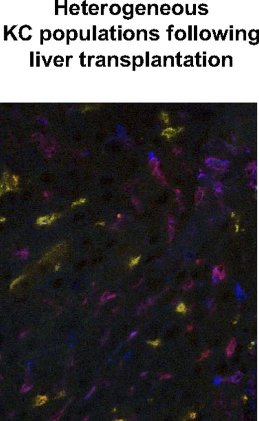 Figure 7. Immunohistologic staining of liver transplants reveals equal numbers of BM-derived and sessile KCs. Frozen tissue sections from liver transplants (B6.CD45.2 liver transplanted into B6.CD45.1 recipient) were stained for macrophages (F4/80 PE), CD45.1 Cy5 (displayed in false color blue) BM-derived cells, and CD45.2 FITC (green) liver transplant-derived cells. Equal numbers of BM-derived ‘KCs (purple-red) and sessile KCs (orange-green) were detected by confocal microscopy.
