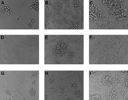 Figure 3. In vitro growth of tumor cell lines. The 9 tumor cell lines display various patterns of growth and sizes in vitro. Most preferentially grow in clusters, although one line, 14736, grows as a single-cell suspension. (A) MML-12933; (B) LCL-13271; (C) ML-13381; (D) CML-14736; (E) CML-15433; (F) LCL-15446; (G) LCL-17016L; (H) LCL-17016P; (I) LCL-17018. Slides were viewed with a Nikon Eclipse TE2000-U microscope (Nikon Instruments, Melville, NY) using Nikon Plan Fluor lenses at 40× in a cell culture media. Images were acquired using a NIkon Eclipse TE2000-U camera (Nikon Instruments) and were processed with Adobe Photoshop Elements version 3.0 software (Adobe Systems).