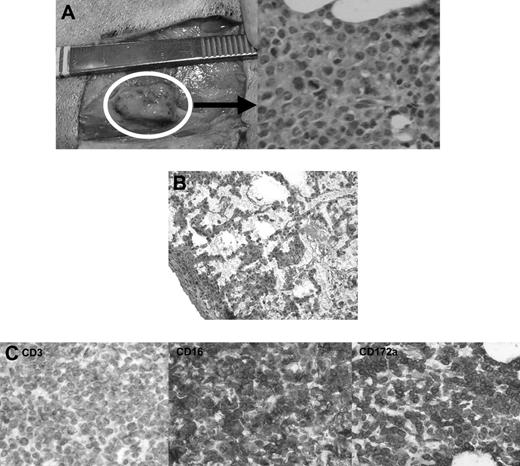 Figure 5. Histologic findings after in vivo transfer of CML-14736 tumor cells into miniature swine. CML-14736 grew after in vivo transfer to histocompatible miniature swine pretreated with TBI. Tumor growth was found at the subcutaneous injection sites (A) and in the lungs after intravenous administration (B). Immunohistochemistry of the subcutaneous injection site tissue negative staining for CD3, but positive staining for CD16 and CD172a, which was consistent with the surface phenotype of the primary tumor and cultured cells (C). Slides were veiwed with a Nikon Eclipse E800 microscope (Nikon Instruments) of sections stained with H&E (Hematoxylin Gill's Formulation no. 2, Fisher Diagnostics; Eosin-Y, Richard-Allan Scientific) using Nikon Plan Fluor lenses at 400× (A right; C left, middle, right) and 200× (B). Images were acquired using Nikon HRD060-NIK 0.6X optical coupler diagnostic instruments (Nikon Instruments) connected to a computer with SPOT-diagnostic instruments and was processed with SPOT Advanced or Basic version 3.5.6 software for Windows (Diagnostic Instruments, Sterling Heights, MI).