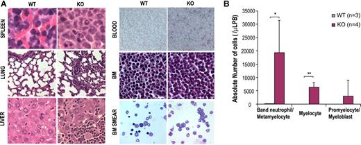 Figure 3. Cdc42 deletion causes myeloid cell infiltration to various organs and accumulation of myeloid precursors in peripheral blood. (A) Cdc42-deficient mice show myeloid expansion in spleen, liver, lung, and bone marrow, as well as peripheral blood. Histologic analyses of spleen, lung, liver, peripheral blood smears, bone marrow, and bone marrow smear from WT or KO mice were carried out. Sections were stained with hematoxylin and eosin (magnifications: ×600 for spleen, lung, liver, bone marrow, and bone marrow smear; ×200 for blood). Slides were viewed with a Nikon Eclipse 50i microscope (Nikon, Tokyo, Japan) using Plan Apo and Plan Fluor lenses at 20×/0.75 PH, 60×/0.85 PH, and 100×/1.30 oil and Micromount mounting medium (Surgical Medical Instruments, Grayslake, IL). Images were acquired using a Spot camera model Insight 4 (Diagnostic Instruments, Irvine, CA) and were processed with Spot software version 4.0.9 (Diagnostic Instruments). (B) Quantification of differential counts of myeloid precursors in peripheral blood. Myelocytes (> 500) at various stages of differentiation were counted by visual inspection of multiple, randomly selected fields under a microscope. *P < .05; **P < .01; and ***P < .001.