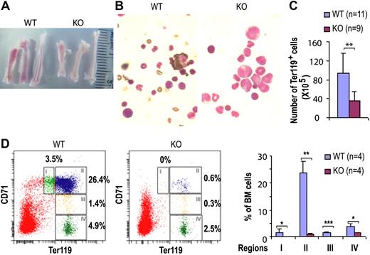 Figure 5. Cdc42 deletion causes defective erythropoiesis. (A) Gross anatomy of bones from WT and KO mice. (B) Visualization of erythroid cells by benzidine staining (magnification × 1000). Slides were viewed with a Nikon Optiphot-2 microscope (Nikon, Melville, NY) using Plan Apo lens at 100×/1.25 oil and Cytoseal 60 mounting medium (Richard-Allan Scientific, Kalamazoo, MI). Images were acquired using a Spot camera model Insight 4 (Diagnostic Instruments) and were processed with Spot software version 4.0.9 (Diagnostic Instruments). (C) The total numbers of Ter119-positive erythroid cells in bone marrow were assessed at 14 DPI. (D) Flow cytometry analysis of CD71 and TER119 expression of freshly harvested bone marrow cells at 19 DPI, with percentages of erythroid cells at different developmental stages shown as in regions I to IV.