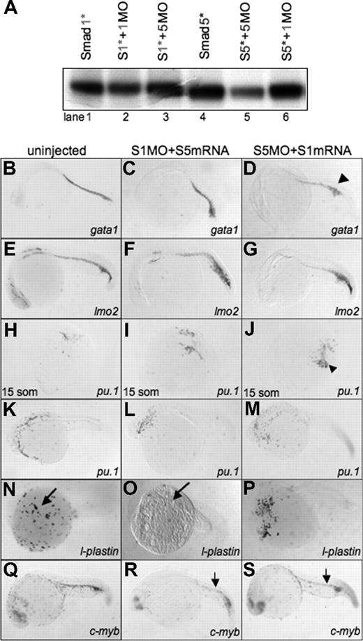Figure 7. Smad1 can rescue the hematopoietic defect in smad5 morphants. (A) In vitro transcription-translation of 35S-methionine–labeled Smad proteins. Translation of wobbled-changed Smad1 and Smad5 (Smad1* or S1* and Smad5* or S5*) are not inhibited by their own MO or the opposite Smad MO (Smad1*, lanes 1-3; Smad5*, lanes 4-6). (B-S) Embryos were either uninjected control (left column) (B,E,H,K,N,Q), coinjected with Smad1 MO plus Smad5 mRNA (middle column) (C,F,I,L,O,R), or Smad5 MO plus Smad1 mRNA (right column) (D,G,J,M,P,S) and processed at 24 hpf for in situ hybridization to identify hematopoietic transcripts: gata1 (B-D), lmo2 (E-G), pu.1 (15 somites, panels H- J; 24 hpf, panels K-M), l-plastin (N-P), and c-myb (Q-S). Smad1 is capable of rescuing gata1 (D) (◀), lmo2 (G), pu.1 (J) (◀), and c-myb (S) (small arrow) in smad5 morphants. However, Smad5 is unable to rescue the loss of l-plastin expression in smad1 morphants (O) (long arrow). Each panel is a representative embryo of a 25-embryo sample. All images are shown whole mount. In panels B-G and L-S, anterior is to the left; in panels H-J, anterior is to the top.