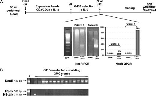 Figure 3. The NeoR transgene is expressed late after transplantation. (A) Synopsis of ex vivo GMC G418 reselection and cloning. The process consists of a 7-day polyclonal (CD3-CD28 beads + IL-2) expansion followed by a 5-day selection in the presence of G418 before cloning. A representative agarose gel electrophoresis of qualitative NeoR PCR is shown. When possible, QPCR for the NeoR gene was applied after the selection step to quantify the selection efficiency. After cloning, screening was performed with both qualitative PCR assays to confirm the presence of the NeoR and HSV-tk genes. (B) Representative 2% agarose gel electrophoresis of screening. Except for 1 clone positive for the truncated form of the HSV-tk gene (311 bp of PCR product), all clones were HSV-tk−/NeoR+. Vertical lines have been inserted to indicate a repositioned gel lane.
