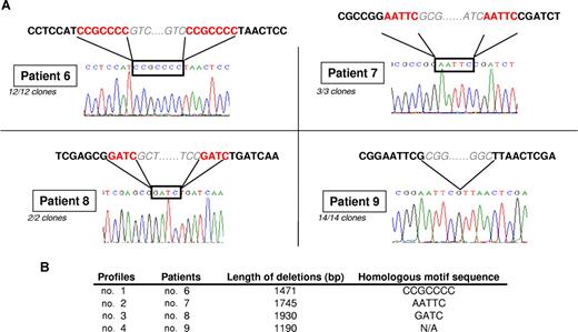Figure 5. Recombination motif sequences may explain the deletion mechanism. (A) Sequencing showed that the junction area corresponded to the homologous motif sequence for 3 of 4 patients and that every clone from the same patient carried the same deletion. (B) Size of deletion and precise homologous motif sequence for each patient.