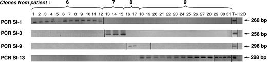 Figure 6. All the NeoR+/HSV-tk− clones from the same patient descend from the same circulating GMC. All 31 NeoR+/HSV-tk− clones were screened with the 4 retroviral insertion-specific PCRs. PCRs were performed with a LTR-specific reverse primer and a forward primer complementary to the genomic sequence where the retroviral sequence was inserted, previously identified after cloning/sequencing of the LAM PCR product. A PCR product of the expected length was detected in every clone of 1 patient and was absent in the 3 others. Vertical lines have been inserted to indicate a repositioned gel lane.