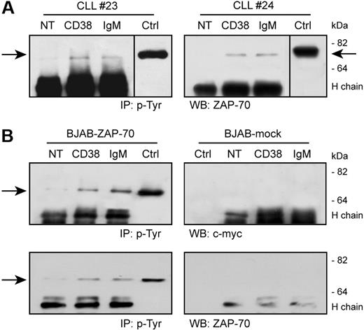 Figure 3. CD38 ligation induces ZAP-70 tyrosine phosphorylation. (A) CLL cells were purified from patients with CLL and ligated with the indicated Ab for 5 minutes at 37°C. Lysates were immunoprecipitated (IP) using an antiphosphotyrosine mAb, followed by Western blot (WB) with an anti–ZAP-70 reagent. The arrows indicate the relevant band; molecular weights are shown on the right. Ctrl indicates control total lysate of BJAB–ZAP-70–transfected cells; NT, not treated; H chain; heavy chain of the precipitating Ab. Vertical line has been inserted to indicate a repositioned gel lane. (B) BJAB–ZAP-70–transfected cells and control BJAB-mock were treated as in panel A. Top panel shows the results of the Western blot with an anti–c-myc mAb, which is confirmed in the bottom panel using an anti–ZAP-70 reagent. No tyrosine phosphorylation of ZAP-70 is observed in the mock-transfected cells. Ctrl indicates control total lysate of BJAB–ZAP-70+ or mock-transfected cells.