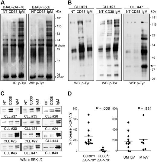 Figure 4. CD38 signaling is dependent on the presence of ZAP-70. (A) CD38 signaling benefits from the presence of ZAP-70. BJAB–ZAP-70+ and mock-transfected cells were treated with the indicated antibodies, and the lysates were immunoprecipitated and blotted using antiphosphotyrosine antibodies. H and L chain refer to the heavy and light chains of the precipitating Ab. (B) Total protein tyrosine phosphorylation profile of 3 patients with CLL upon CD38 or IgM ligation (5 minutes, 37°C). CLL no. 21 and no. 27 were CD38+/ZAP-70+, while no. 47 was CD38+/ZAP-70−. The arrow shows a band likely corresponding to ERK1/2. No increase in protein tyrosine phosphorylation was observed with CLL no. 47 cells. (C) Analysis of ERK1/2 phosphorylation in a subset of 12 patients with CLL upon CD38 and IgM ligation. CD38+/ZAP-70+ cells show a clear increase in phosphorylation compared with CD38+/ZAP-70− cells. (D) ERK1/2 phosphorylation was studied in 26 patients with CLL; gels were scanned and the band intensities were measured by the ImageJ software and plotted by dividing the patients according to different molecular parameters. The only statistically significant difference is observed by dividing CD38+ patients (n = 17) on the basis of ZAP-70 expression (left panel). No difference is scored when using IgV mutations (right panel). Data are expressed as percentage of increase in ERK1/2 phosphorylation compared with background; the horizontal line represents the mean of all samples. Statistical difference was calculated according to the Student 2-sample, 2-tailed t test.