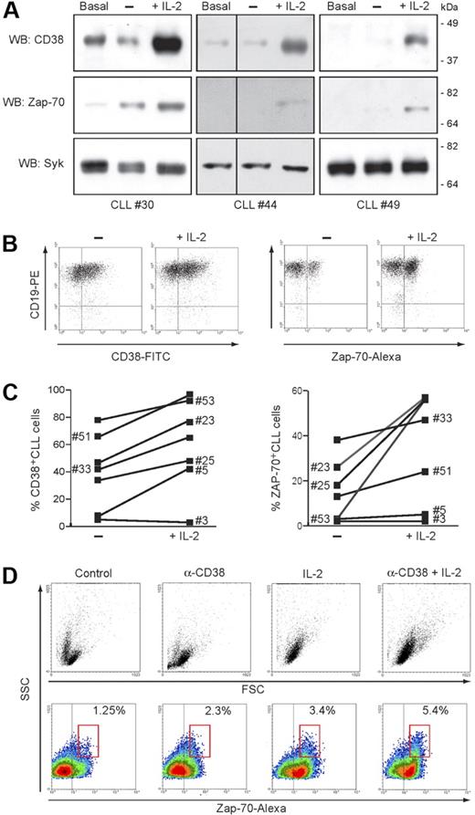 Figure 5. CD38 and IL-2 signaling upmodulate ZAP-70. (A) Purified CLL cells from 3 representative patients were cultured for 72 hours in the presence of IL-2 (100 IU/mL). Lysates were probed for CD38, ZAP-70, and syk using specific antibodies. Basal refers to freshly purified cells, while “−” refers to cells cultured for 72 hours without IL-2. Vertical lines have been inserted to indicate a repositioned gel lane. (B) PBMCs from 19 patients with CLL were cultured as in panel A, and CD38 and ZAP-70 was assayed by intracellular staining. Specificity for B cells was confirmed by counterstaining with an anti-CD19 mAb, as shown in the dot plot. (C) Effects induced by IL-2 exposure on the number of CD38+ and ZAP-70+ CLL cells in 7 representative patients. (D) ZAP-70 expression is increased following CD38 signaling in the presence of IL-2. Purified CLL cells from 5 patients were cultured for 5 days in the presence of agonistic anti-CD38 mAb, IL-2, or a combination of the 2 (CD38 + IL-2). The top panel shows the morphologic changes in the population as a dot plot of forward scatter (FSC) and side scatter (SSC). Bottom panels show density plots of ZAP-70 and SSC. A marked increase in ZAP-70 expression is apparent after treatment with anti-CD38 mAb or IL-2 and is boosted by the combination of the 2. Percentages indicate ZAP-70+ CLL cells within the red gate, highlighting cells with highest SSC values.