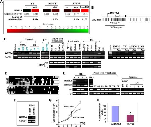 Figure 1. WNT5A is epigenetically silenced in hematologic malignancies and inhibits leukemic cell growth. (A) Expression levels of WNT5A mRNA in 5-aza-2′-deoxycytidine (Aza)–treated and untreated nasal NK/T-cell lymphoma (NK-YS and SNK-6) and NK leukemia (YT) cell lines. The data were obtained with microarray (Human Genome U133 Plus 2.0 Microarray, Affymetrix, Santa Clara, CA) expression analysis by GeneSpring version 7.3.1 software (Agilent, Palo Alto, CA). The degree of WNT5A up-regulation after Aza and TSA treatment is also shown. Red color represents high expression whereas green color represents low expression. (B) The CpG island (CGI) of the WNT5A promoter includes the core promoter, exon 1, and part of intron 1. The transcription start site is indicated by a curved arrow. The MSP and BGS regions analyzed in the CGI are indicated. (C) Semiquantitative RT-PCR and MSP analyses of WNT5A in normal cells and tissues and tumor cell lines. WNT5A expression in cell lines after treatment with 5 μM Aza7 is shown on the right. GAPDH was used as a control. The WNT5A expression levels among different PBMC samples could be variable. M indicates methylated; and U, unmethylated. (D) High-resolution methylation analysis of the WNT5A promoter in 2 leukemia cell lines by BGS, showing the methylation status of every CpG site in the studied region. Each row in the grid represents an individual allele of the WNT5A promoter. ■ and □ represent methylated or unmethylated CpG sites, respectively. (E) Representative MSP results of primary BL, nasal NK/T-cell lymphoma, normal PBMCs, and LN tissues. RT-PCR results of several primary BL and 1 nasal NK/T-cell lymphoma are also shown. (F) Expression levels of WNT5A in silenced K562 cells before and after transfection were determined by RT-PCR. (G) Growth curves of K562 cells after transfection with pcDNA3.1-WNT5A or control vector. At indicated time points after transfection, cell numbers were counted and plotted. Mean values plus or minus SD of triplicate experiments are shown (*P < .05). (H) Quantitative analysis of colony numbers after transfection with pcDNA3.1-WNT5A and G418 selection in K562. The number of G418-resistant colonies in the control vector–transfected cell line was set to 100%. Mean values plus or minus SD of 3 separate experiments are shown.