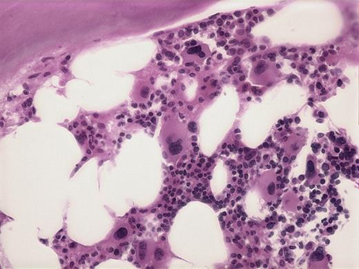 Peter Maslak, Memorial Sloan Kettering Cancer Center