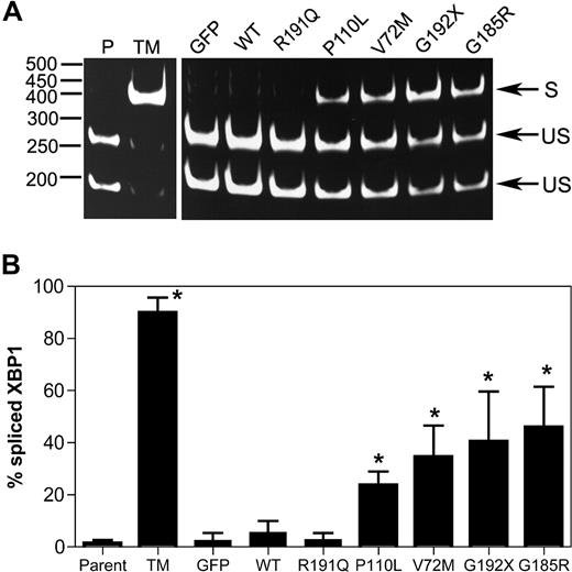 Figure 1. Expression of mutant NE induces XBP1 splicing in U937 cells. U937 cells were transiently transfected with vector alone (GFP), wild-type (WT), or mutant NE cDNAs, and 12 hours later GFP + cells were sorted by flow cytometry. As controls, parent U937 cells (P) and cells treated with tunicamycin (TM) also were analyzed. (A) Representative gel showing spliced (S) and unspliced (US) XBP1 bands. (B) The percentage of spliced XBP1 is shown. Data represent the mean (± SD) of 5 independent experiments. *P < .05 compared with WT-transfected cells.