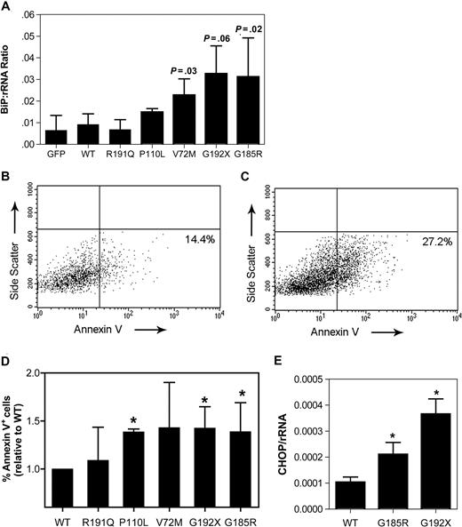Figure 4. Expression of mutant NE activates UPR-induced apoptosis in promyelocytes. Cultured human promyelocytes were transiently transfected with vector alone (GFP) or the indicated NE cDNA. (A) BiP mRNA expression relative to rRNA was determined on sorted GFP+ cells 12 hours after transfection. (B,C) Representative scatter plots of annexin V expression on cells transfected with WT (B) or G185R NE (C); data are gated on GFP+ 7AAD− cells. Gates were set based on untransfected cells (not shown). (D) The percentage of GFP+ 7AAD− cells that were annexin V+ at 24 hours after transfection is shown. Data are normalized to WT-transfected cells, where the percentage of annexin V+ cells was defined as 1. (E) CHOP mRNA expression relative to rRNA was determined on sorted GFP+ cells 12 hours after transfection. Data represent the mean (± SD) of 4 to 6 independent experiments * P < .05 compared with WT-transfected cells.