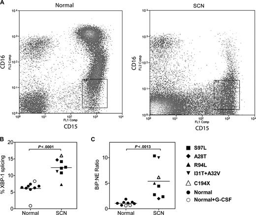 Figure 6. The UPR is activated in SCN promyelocytes/granulocytes. (A) Representative scatter plots of bone marrow cells from a healthy donor (normal) and a patient with ELA2-mutation positive SCN (A28T) stained for CD15 and CD16; data are gated to exclude CD14+ monocytes and CD9+ eosinophils. The boxed region shows the sorted CD15+ CD16lo CD14− CD9− cell population. (B) The percentage of spliced XBP-1 mRNA in the sorted cell population is shown. (C) Expression of BiP mRNA relative to NE mRNA in the sorted cell population is shown.