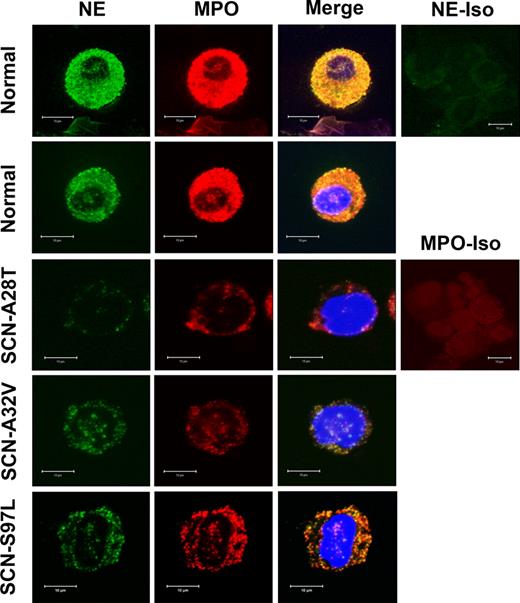 Figure 7. NE and MPO protein expression is decreased in SCN granulocytic precursors. Confocal microscopy of 2 different healthy donors (normal) and 3 ELA2-mutant SCN samples stained with NE and myeloperoxidase (MPO; a primary granule constituent). Isotype controls for NE and MPO are shown. Data are representative of 6 normal and 6 ELA2 mutation-positive SCN bone marrow samples.
