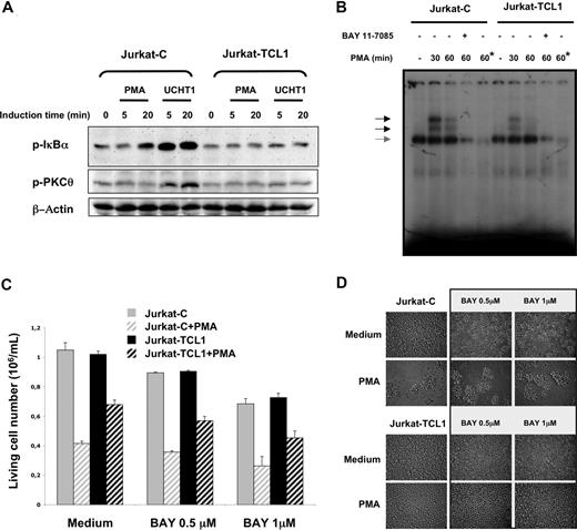 Figure 3. TCL1 inhibits NF-κB activation. (A) Jurkat-C and Jurkat-TCL1 were stimulated with PMA or UCHT1 at different times indicated in the figure. IκBα (p-IκBα, top) and PKCθ (p-PKCθ, middle) phosphorylation was determined by Western blotting. β-Actin expression was used as a loading control (bottom). A representative experiment of the 3 performed is shown. (B) Band shift assay of nuclear extracts from Jurkat-C and Jurkat-TCL1. Cells were either untreated or stimulated for 30 and 60 minutes with PMA in presence or absence of Bay 11-7085 as indicated in the figure. A constitutive DNA binding of NF-κB with the same intensity in Jurkat-C and Jurkat-TCL1 is indicated by a gray arrow. Asterisk (*) indicates lane containing a 100-fold excess of cold KBF1 oligonucleotide competitor. (C) Jurkat-C (▒) and Jurkat-TCL1 (■) were seeded at 0.5 × 106 cells/mL, and treated (□) or untreated (plain box) with PMA (20 ng/mL) in presence or absence of Bay 11-7085 added 1 hour before and during the stimulation period at indicated concentrations. The viable cell number was determined at 48 hours, using a cell viability analyzer (Vi-cell XR; Beckman). Data are expressed as mean (± SE) of duplicates samples. One additional experiment gave similar results. (D) Photomicroscopy of Jurkat-C and Jurkat-TCL1, treated or untreated with PMA for 3 days in presence or absence of Bay 11-7085 at indicated concentrations. Two additional experiments gave similar results.