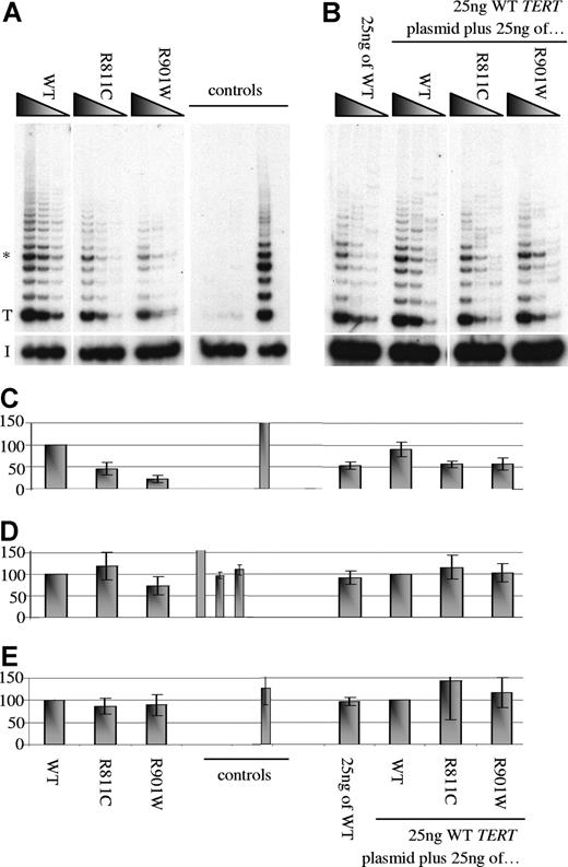 Figure 4. Reconstitution of telomerase activity of TERT mutations in vitro. (A) The presence of the TERT amino acid substitutions reduces reconstituted telomerase activity in vitro. (B) There is no evidence of a dominant-negative effect. Serial dilutions of each transfected lysate were assayed as described in “Quantitative real-time-PCR on primary material.” The control panel contains 2 sets of data: the first triplet contains mock transfection, luciferase plasmid alone, and luciferase with WT TERC plasmid lysates, which were expected to yield no telomerase activity but similar luciferase levels; the second half shows HeLa (+) and heat-inactivated HeLa (−) lysates. T and I denote the start of the TRAP ladder and the corresponding internal control, respectively. (C) Densitometry readings using the triplicate band highlighted with * in panel A were analyzed.34 The means and SD from 3 separate transfection and subsequent TRAP experiments are shown. (D) Luciferase levels (expressed as a percentage of counts/μg protein compared with the WT sample) and (E) TERC levels (normalized using ABL and expressed as a relative percentage compared with the WT sample) were concordant among lysates analyzed from 3 separate transfection and TRAP analysis experiments. The amino acid substitutions are shown above the panels and below the graphs.