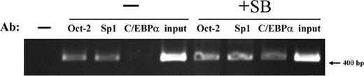 Figure 4. Association of Oct-2, Sp1, and C/EBPα transcription factors with the IGnTC gene 5′ promoter region. The association of Oct-2, Sp1, and C/EBPα transcription factors with the 5′ promoter region (−322 to +62 bp) of the IGnTC gene in K-562 cells was examined using ChIP analysis. A total of 1 × 107 K-562 cells with or without sodium butyrate treatment (indicated as +SB and −, respectively) were used. The chromatin DNAs immunoprecipitated with 1:500 dilutions of anti–Oct-2, anti-Sp1, or anti-C/EBPα antibodies (Ab) and the input DNA controls were used for PCR amplification. Butyrate-treated cells were used for the no-antibody control in PCR amplification (leftmost lane).