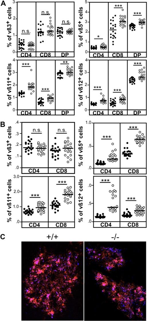 Figure 5. Impaired negative selection of CCR7-deficient thymocytes in response to endogenous SAgs. (A) Negative selection of Vβ5+, Vβ11+, and Vβ12+, but not of Vβ3+, thymocytes is impaired in CCR7-deficient mice. (B) Increased proportions of Vβ5, Vβ11, and Vβ12 lymphocytes in the spleen of CCR7-deficient mice, indicating that autoreactive cells escaping negative selection in the thymus are not deleted in the periphery and, therefore, could induce the development of autoimmunity in these mice. Data has been subjected to unpaired T test. P values less than or equal to .05 were considered significant. (C) Clusters of G8.8+/UEA-1+ epithelial cells are present in the medulla of CCR7-deficient animals, demonstrating that impaired negative selection of thymocytes reactive to endogenous SAg is not due to the absence of cells able to induce their deletion. Cryosections of the thymus from wild-type and mutant mice were stained with antibodies to EpCAM1 (G8.8, red) as well as with UEA-1 (blue). Images were acquired using a Zeiss Axiovert M200 microscope. Objective magnification, 10×/0.45 NA.