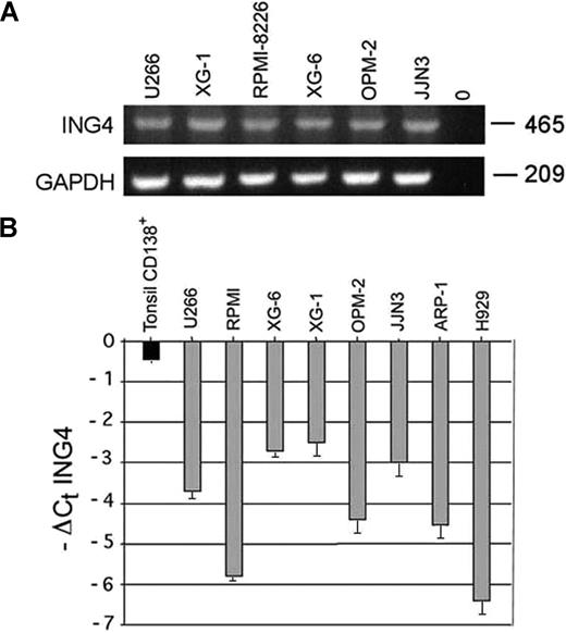 Figure 1. ING4 expression by human myeloma cell lines (HMCLs). ING4 mRNA expression was evaluated by RT-PCR in several HMCLs (U266, XG-1, RPMI-8226, XG-6, OPM-2, JJN3). GAPDH was used as internal control (A). ING4 mRNA levels were quantified by real-time PCR in HMCLs. Data are expressed (graphs) as −ΔCt ING4: −(mean Ct ING4 − mean Ct ABL) plus or minus SD of triplicate measures. Purified tonsil CD138+ plasma cells were used as healthy control (B).