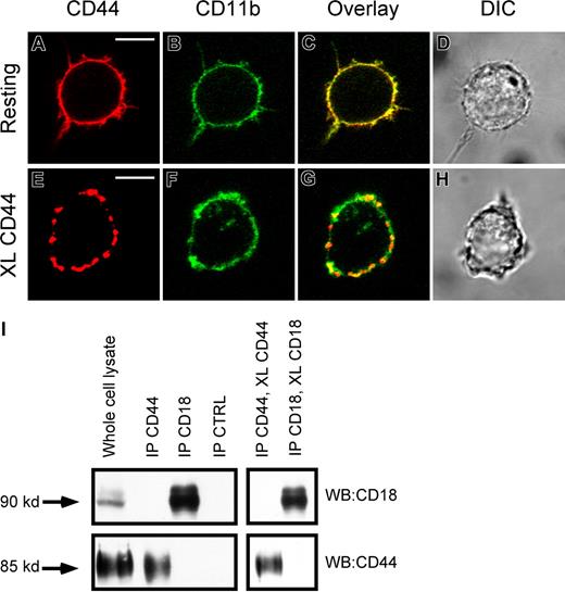 Figure 4. Lack of evidence of physical interaction between CD44 and CR3 (CD11b/CD18). (A,B) Immunofluorescence images of CD44 (red) CD11b (green) of resting RAW macrophages. (C,D) Overlay and direct interference contrast (DIC) images. (E,F) Immunofluorescence of CD44 (red) and CD11b (green) of CD44 cross-linked RAW macrophages. (G,H) Overlay and DIC images. XL indicates cross-linking. Scale bars represent 5 μm. (I) As determined by Western analysis of CD44 and CD18 immunoprecipitates, no detectable binding of the other molecule was observed in the immune complexes. Images are representative of 3 independent experiments.