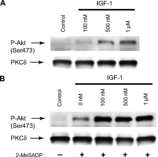 Figure 5. Akt is phosphorylated in response to IGF-1 in platelets. (A) Washed platelets were stimulated with different concentrations of IGF-1 for 3 minutes at 37°C without stirring. (B) Platelets were stimulated simultaneously with 2-MeSADP (100 nM) and different concentrations of IGF-1 for 3 minutes at 37°C. The reaction was stopped by the addition of 3 × SDS sample buffer. Samples were separated by SDS-PAGE, transferred onto polyvinylidene difluoride membranes, and probed with anti-phospho-Akt (Ser473) or anti-PKCδ (lane loading control) antibody. The data shown are representative of 3 experiments.