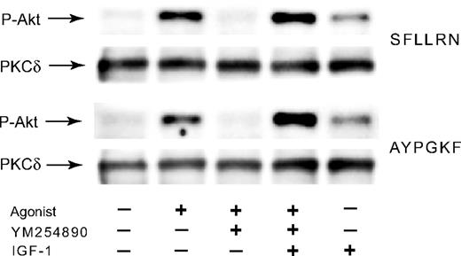 Figure 7. IGF-1 restores SFLLRN- and AYPGKF-induced Akt phosphorylation upon blockade of Gq pathways in platelets. Aspirin-treated, washed human platelets preincubated with 50 nM YM-254890 were stimulated at 37°C for 3 minutes with either SFLLRN (3 μM) or AYPGKF (200 μM) in the absence and presence of 100 nM IGF-1. The reaction was stopped by the addition of 3 × SDS sample buffer. Platelet proteins were separated by SDS-PAGE, Western-blotted, and probed for anti-phospho-Akt (Ser473) or anti-PKCδ (lane loading control) antibody. The blot shown is a representative of 3 independent experiments.