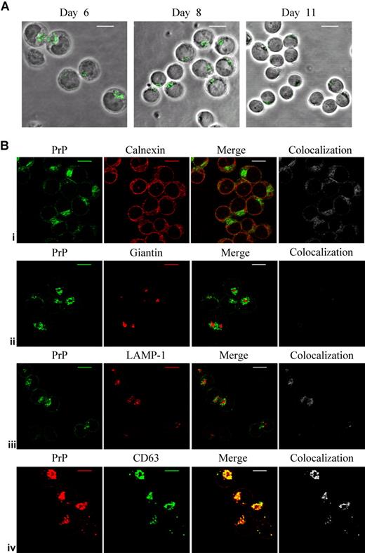 Figure 1. PrPc expression in human erythroid cells cultured in vitro. (A) Erythroblasts were harvested on days 6, 8, and 11 of culture. After seeding overnight onto poly-L-lysine–coated slips, cells were fixed and permeabilized and then incubated with PrP mAb ICSM18 and subsequently with goat anti-mouse FITC. Scale bars equal 10 μm. (B) Day-6 erythroblasts were fixed and permeabilized. Dual staining of cells with PrP mAb ICSM18 show in green, and ER marker calnexin (i), Golgi marker giantin (ii), and lysosomal marker LAMP-1 (iii) shown in red. Bottom row (iv) shows PrP mAb (red) dual stained with CD63 mAb (green). Colocalization is highlighted in the grayscale image. Scale bars equal 10 μm.