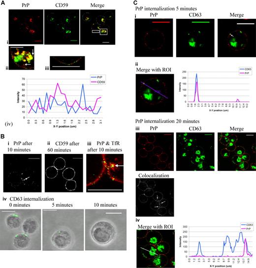 Figure 2. PrPc and CD59 occupy different microdomains in the plasma membrane, and PrPc cycles rapidly from the plasma membrane to the internal membranes. (Ai) Fixed and permeabilized day-7 erythroblasts were dual stained with PrP mAb (red) after use of conversion antibody 1/10 and CD59 (green) and subsequently stained with FITC and TRITC secondary antibodies. Overlays were prepared and highlighted areas from merge magnified to show (Aii) internal PrP-containing vesicles (arrows) and (Aiii) the plasma membrane. The profile (Aiv) of PrP and CD59 fluorescence colocalization in the surface of the cell membrane was analyzed by quantitation software (Leica). Scale bars equal 10 μm (Ai), 5 μm (Aii,iii). (B) Internalization assays were performed to compare the internalization of PrP and CD59 in erythroid cells. After allowing binding of the relevant antibody to the cell surface, cells were incubated at 37°C for up to 60 minutes to allow endocytosis to occur. (Bi) PrP is internalized within 10 minutes endocytosis (grayscale; arrow). (Bii) CD59 is not internalized after 60 minutes endocytosis (grayscale). (Biii) Dual staining of PrP (green) and TfR (red) after 10 minutes of endocytosis (arrow indicates internal colocalization). (Biv) Internalized CD63 was observed inside the erythroblasts at 5 and 10 minutes. Scale bars equal 10 μm. (C) PrP mAb (red) was subject to the internalization protocol, fixed and permeabilized, incubated with conversion antibody (1/10), and then dual stained with CD63 mAb (green). Cell-surface and internalized PrP only is shown stained in red and total CD63 in green. Areas of colocalization are yellow. (Ci) Internalized PrP after 5 minutes (red) and CD63 (green) colocalize in a vesicle-like structure just under the plasma membrane (arrow). (Cii) A region of interest (ROI) was drawn through the cell to include internalized PrP, and a profile of green and red fluorescence along this ROI was constructed using Leica quantiation software. (Ciii) Internalized PrP after 20 minutes (red) and CD63 (green) colocalize deep within the cell. Grayscale image shows areas of colocalization between PrP and CD63 only (arrows). (Civ) An ROI was drawn through a cell to include internalized PrP, and a profile of green and red fluorescence along this ROI was constructed using Leica quantiation software. Scale bars equal 10 μm.