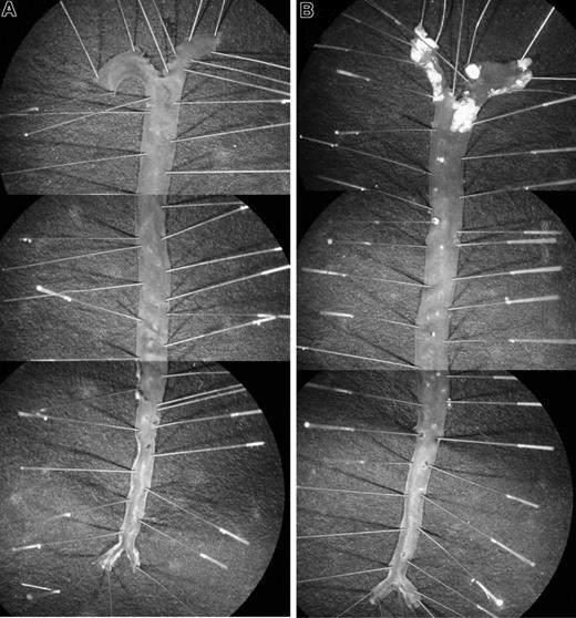 Figure 1. Atherosclerotic lesions. Typical appearance of aortas from apoE+/+HCII−/− (A) and apoE−/−HCII−/− (B) mice. Mice were fed a Western diet beginning at 8 weeks of age and were killed at 20 weeks of age. To show the entire aorta in a single image, each panel is a composite of 3 adjacent microscopic fields. Atherosclerotic plaques are present in the aortic arch and to a lesser extent in the thoracic aorta of the apoE−/−HCII−/− mouse (B).