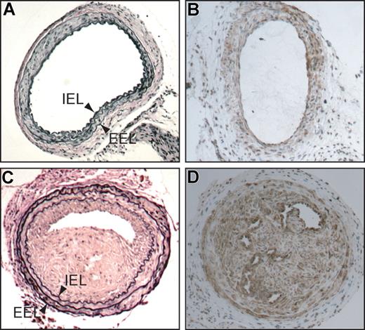 Figure 3. Common carotid arteries of HCII−/− mice 3 weeks after mechanical dilation with a beaded wire probe. (A,C) Cross sections stained with Verhoeff van Gieson stain for elastin. (B,D) Cross sections stained with a monoclonal anti–α-smooth muscle actin IgG. (C,D) Injured (left) arteries. (A,B) Contralateral uninjured (right) arteries. IEL indicates internal elastic lamina; EEL, external elastic lamina.