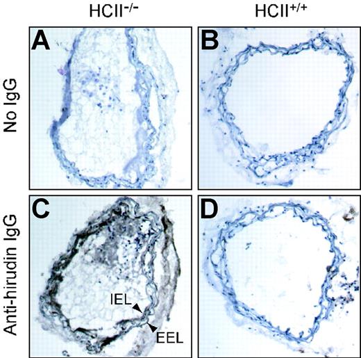 Figure 6. Binding of hirudin to arterial sections. Frozen sections were prepared from carotid arteries of HCII−/− (A,C) or HCII+/+ (B,D) mice harvested 1 hour after injury. The sections were then incubated with hirudin in vitro, and bound hirudin was detected with sheep anti–hirudin IgG and a secondary antibody linked to peroxidase (C,D). Controls in which the primary antibody was omitted are shown (A,B). A thrombus is visible in the arterial lumen of the HCII−/− mouse. IEL indicates internal elastic lamina; EEL, external elastic lamina.