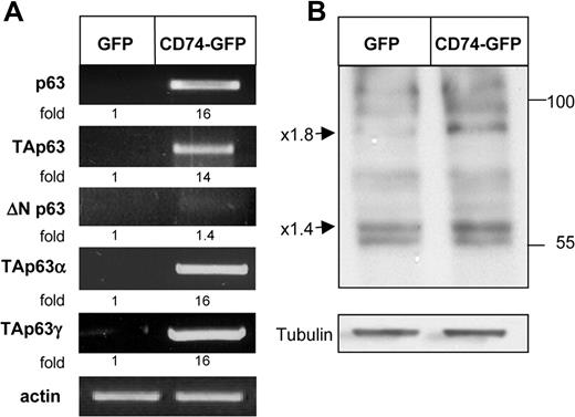 Figure 2. CD74 up-regulates TAp63 α and γ expression. (A) HEK-293 cells were transfected with GFP or CD74-GFP constructs for 20 hours. Total RNA was isolated and reverse transcription was carried out using Superscript II RT. RT-PCR was performed to determine p63, TAp63, ΔNP63, TAp63α, and TAp63γ mRNA levels. The results presented are representative of 3 to 10 experiments. (B) HEK-293 cells were transfected with GFP or CD74-GFP constructs for 20 hours. Cells were collected and lysed as described in “Cell lysis by hot SDS,” and lysates were separated on 5% to 15% (wt/vol) gradient SDS-PAGE and blotted with anti-p63 antibody followed by HRP-conjugated antirabbit antibodies. The arrows indicate bands of 80 and 56 kDa, representing p63TAα and p63TAγ. The results presented are representative of at least 4 separate experiments. The intensity of the p63 band was divided by the intensity of the actin or tubulin band. The activation fold ratio in the GFP-transfected cells was normalized to 1, and the ratio for each transcription was calculated as the intensity of the sample, relative to 1.