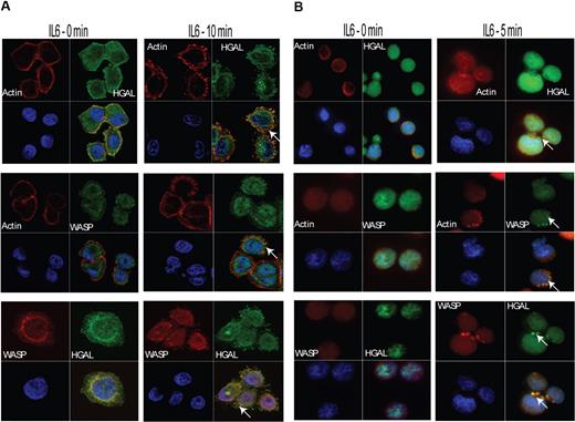 Figure 2. IL-6 stimulation induces colocalization of HGAL with actin and WASP proteins in podosomes. Unstimulated or IL-6–stimulated Hela-HGAL (A) and SUDHL6 (B) cells were fixed with 4% paraformaldehyde and stained with anti-HGAL antibody (green), anti-WASP antibody (green or red, as indicated), rhodamine-labeled phalloidin (red), and DAPI (blue), and were visualized on a Carl Zeiss LSM510 microscope. Arrows indicate podosome-like structures. Representative photographs of 3 independent experiments are shown (see “Immunofluorescence microscopy” for image acquisition information).